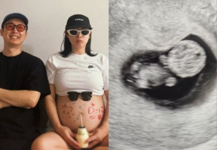설유진 시험관 임신, 두 번의 유산 끝에 기적처럼 찾아온 아기 ‘망....