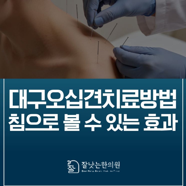 대구오십견치료방법 침으로 볼 수 있는 효과 총정리