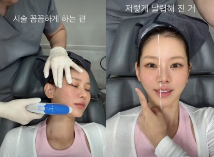"평생 얼굴 해줄게" 맹승지, '♥병원장 남친'에게 직접 시술받은 리....
