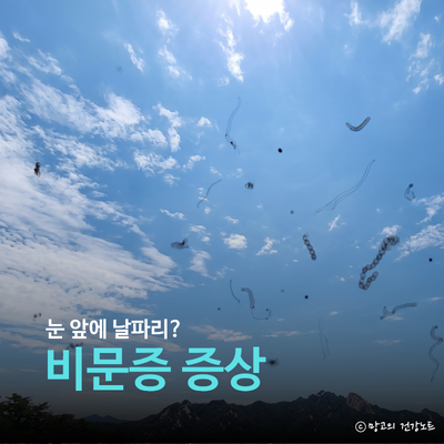 눈에 날파리 비문증 증상, 원인, 치료, 완치