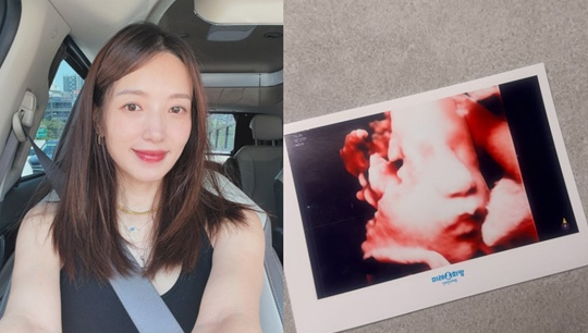 46세에 품에 안은 기적 김민경 아들 출산이 더 특별하게 느껴진 이유