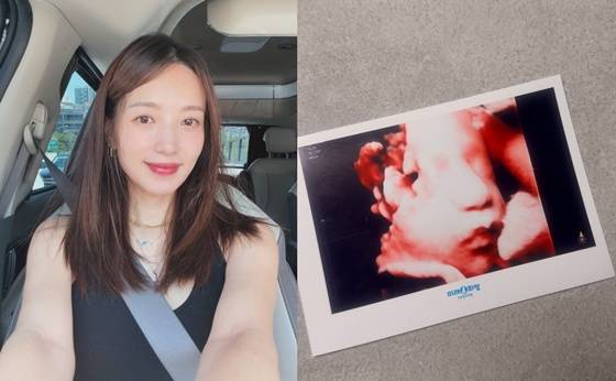 김민경, 46세 아들맘 2.72kg 아들 출산…드디어 아들맘 됐다