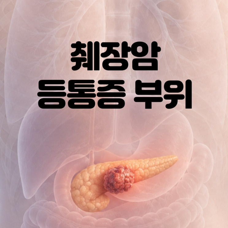 등통증 이 부위면 위험? 췌장암 초기증상 5가지와 검사방법