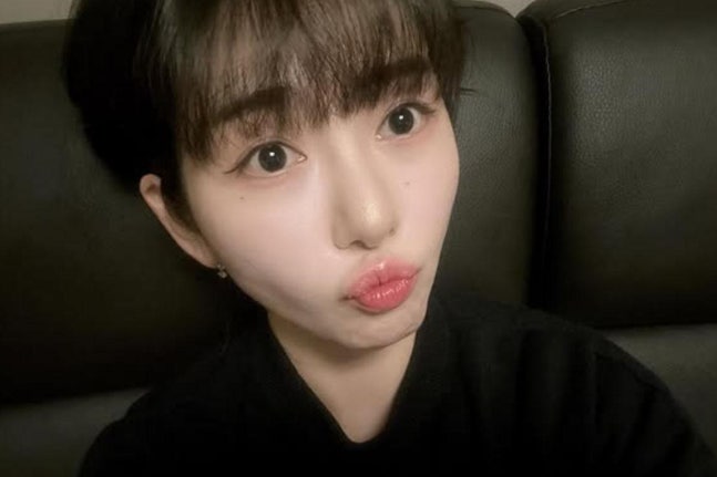 권민아, 성형 안 했다…외모 변화 의혹에 직접 해명