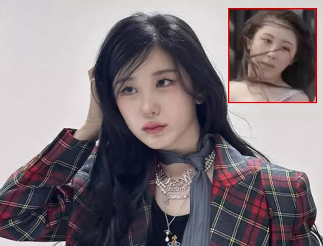3571모 모발이식 했다고? 이채연, 워터밤 탈모설 겪고 모발이식 한 사....