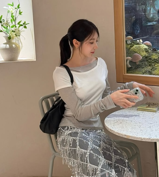 이채연 모발이식 3571모 받은 이유와 전 후 사진