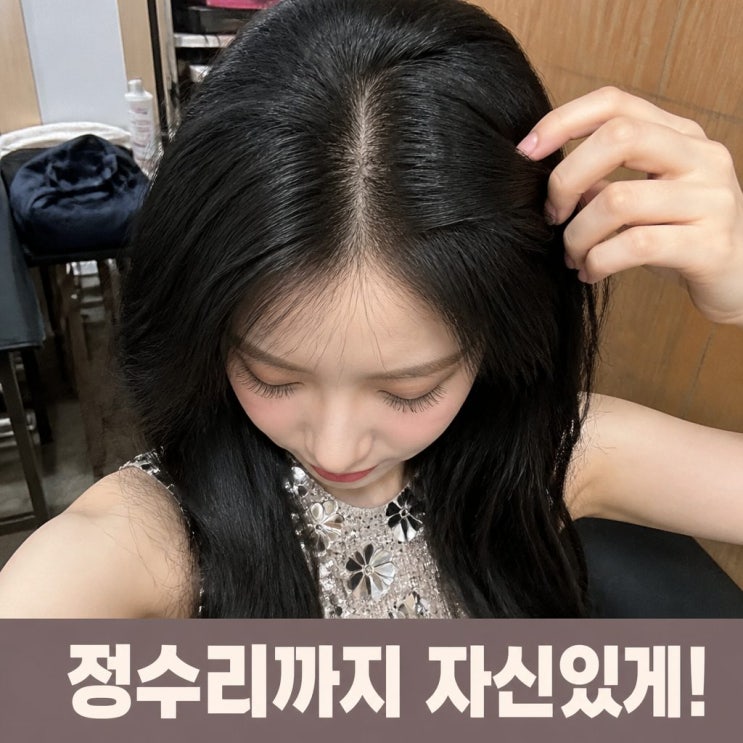 이채연 3571모 모발이식 정수리샷도 자신있는 이유