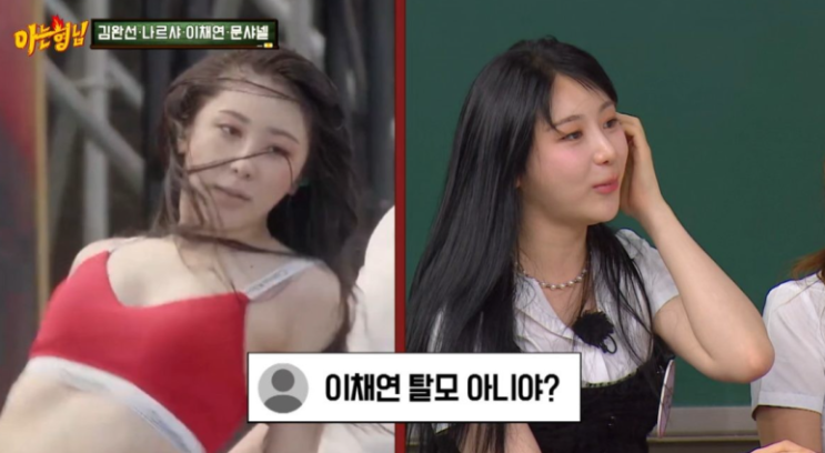 이채연 3571모 모발이식 고백, 탈모라서 흑채 뿌리고 다녔었음? ㅋㅋ