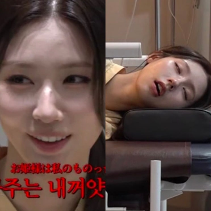 아이들 미연, 수면 내시경 논란? 실제 삽입 장면 공개에 의료법 진정....