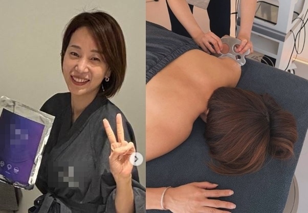 허양임 고지용 이혼 후 몸매 시술 솔직 고백, 진짜 이유는?