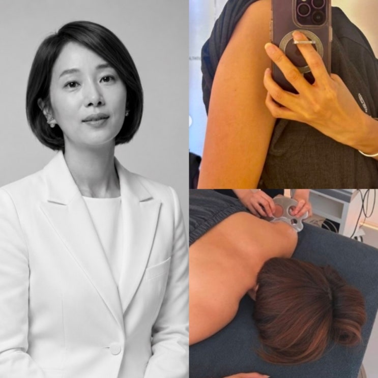 허양임 고지용 이혼 후 몸매 시술, 팔뚝 보고 충격 다이어트 이어 탄....
