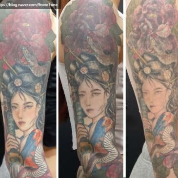큰 문신 지우기 전 필수 확인! 작은 문신보다 제거가 까다로운 이유 3가지 (사진포함)