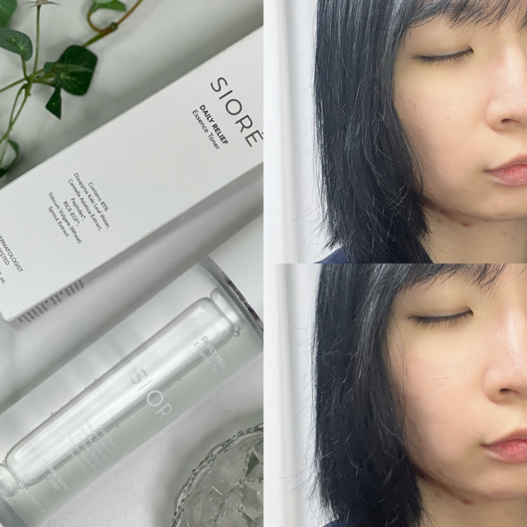 진정토너추천 시오레 데일리 릴리프 에센스 토너 후기 : 네이버 블로그