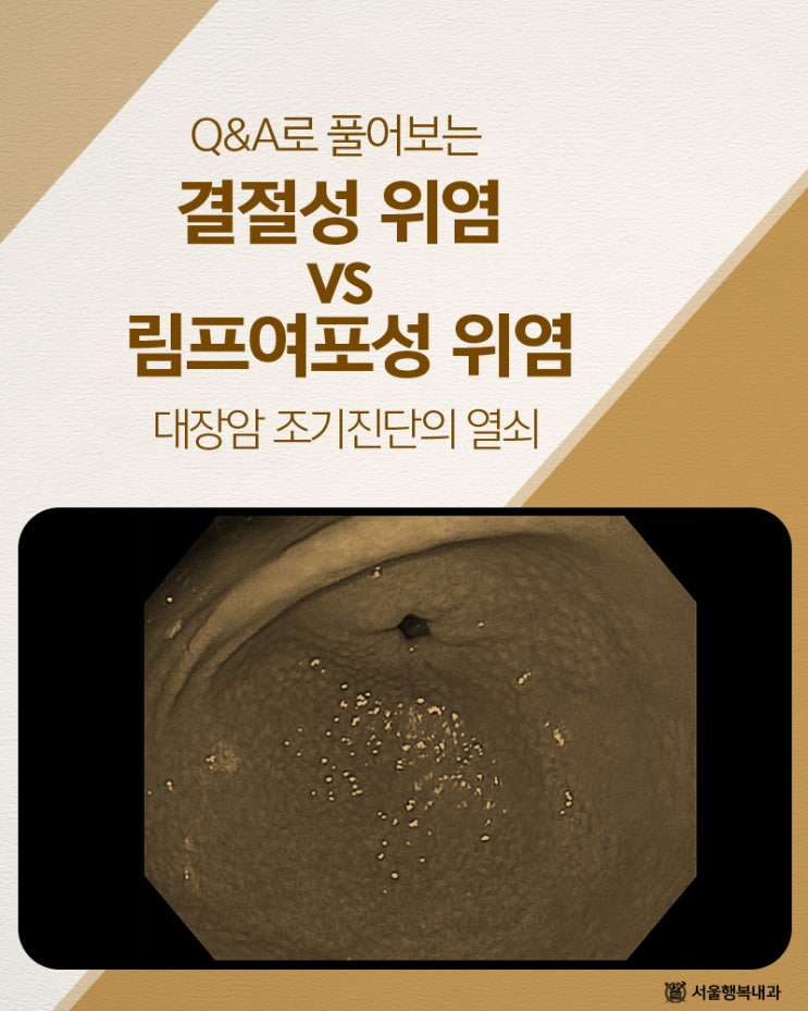 위내시경에서 확인되는 결절성 위염과 림프여포성 위염 : Q &A : 네이버 블로그