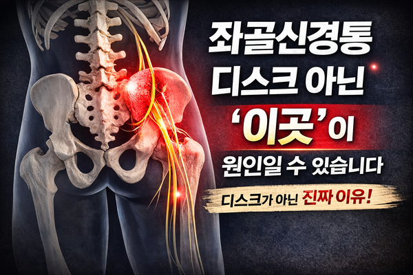 좌골신경통, 디스크가 아닌 ‘이곳’이 원인일 수 있습니다 : 네이버 블로그