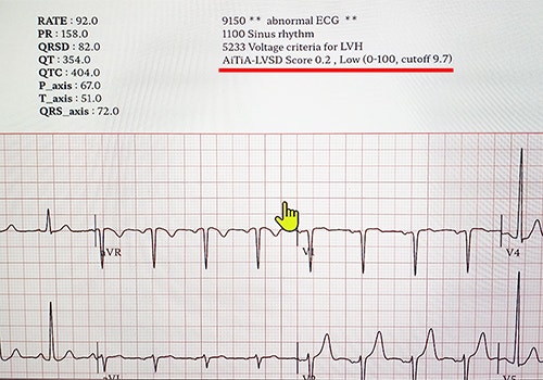 ECG 결과에서 AiTiA LVSD 점수 : 네이버 블로그