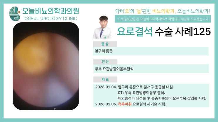 요로결석 치료사례 #125 - 요관결석 : 네이버 블로그