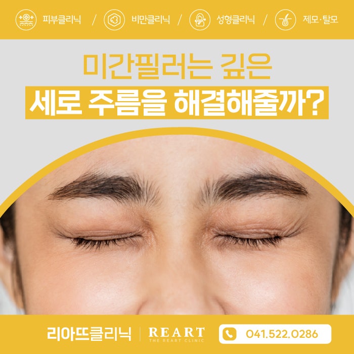 천안 미간필러가 깊은 세로 주름을 해결해줄까? : 네이버 블로그