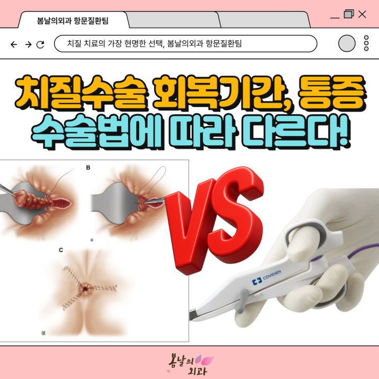 치칠수술의 회복기간과 통증 걱정, 수술법을 꼭 확인해야 : 네이버 블로그