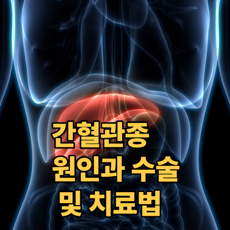 간혈관종 원인과 수술 및 치료법 : 네이버 블로그