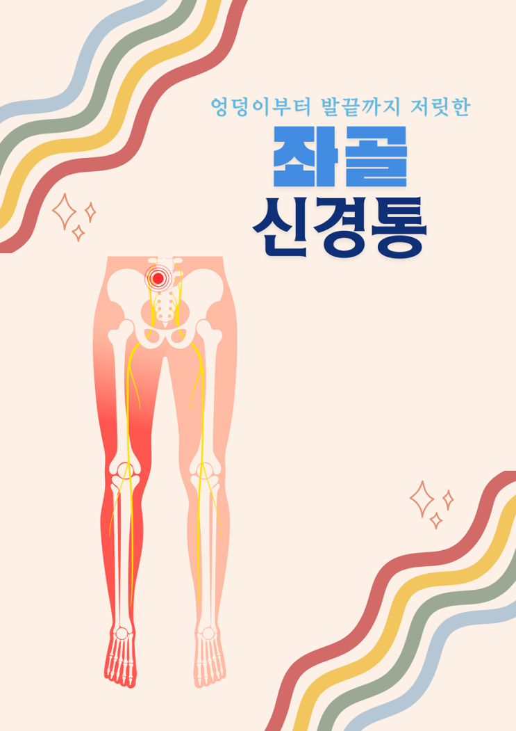 좌골신경통으로 엉덩이부터 발끝까지 저릿하다면 : 네이버 블로그