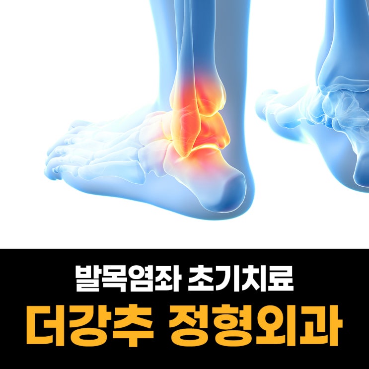 발목 염좌, 초기 치료가 중요한 이유 : 네이버 블로그