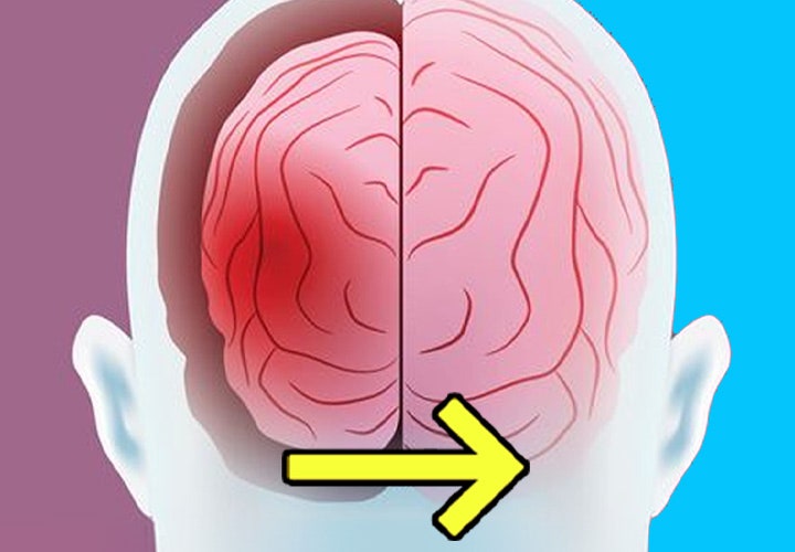40대 넘어서도 뇌가 좋아질 수 있는 '기적의 뇌 안티에이징' : 네이버 블로그