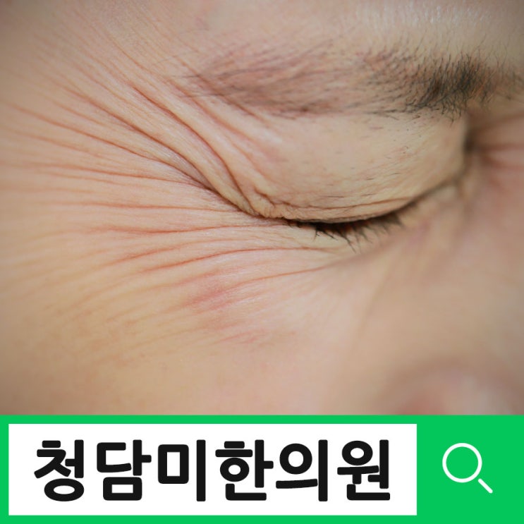 수성구설염 혀통증, 말할때마다 통증이 너무 심해요 | 구강작열감 설통 혀마름 대구 만촌역 청담미한의원 : 네이버 블로그