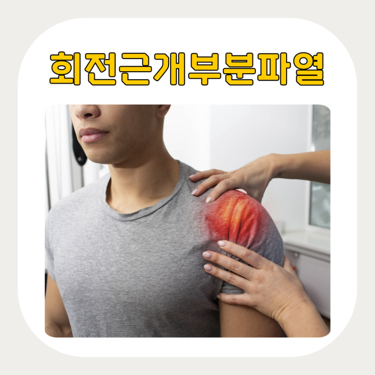 회전근개 부분파열, 운동을 계속해도 될까? : 네이버 블로그