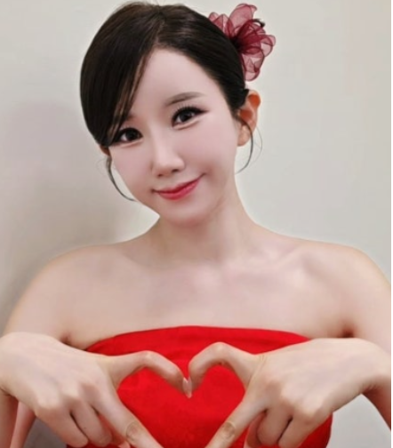 김다나 '뇌수술' 아냐, 이마 혈관 염증 제거 수술… "미스트롯4 활동 이상 없다"