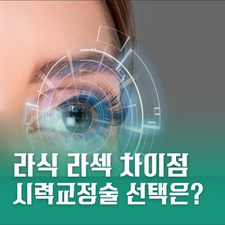 라식 라섹 차이 시력교정술 어떤게 좋을까? : 네이버 블로그