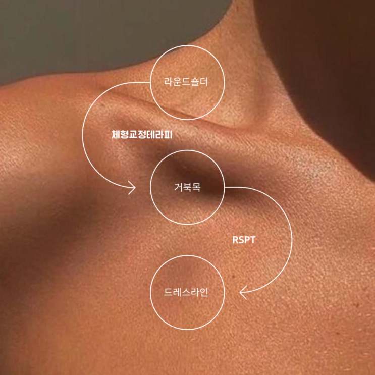 RSPT 라운드숄더 : 네이버 블로그
