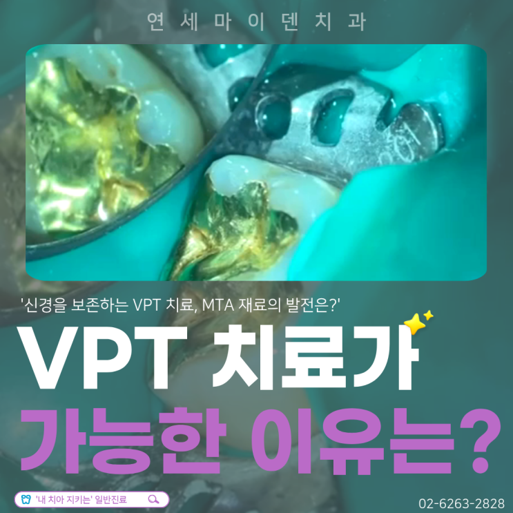VPT 치료란 무엇인가요? VPT(생활치수치료) 알아보기 | 종로 치과 : 네이버 블로그