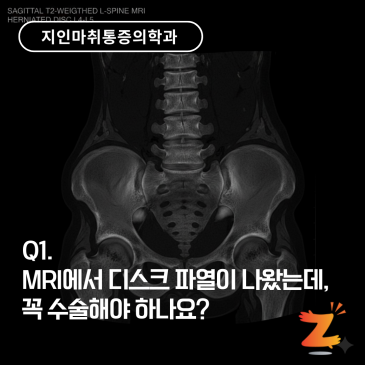 지인마취통증의학과, 환자분들이 가장 궁금해하는 질문 7가지