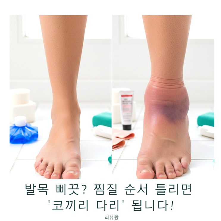 발목 염좌 파스 찜질 순서 틀리면 고생! 3일간 직접 붙여본 솔직 후기 : 네이버 블로그