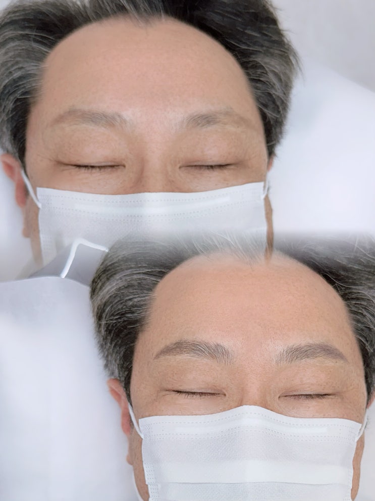 중년 남자 눈썹문신 반감 있으셨다면? 다이아페더링으로 자연스러운 눈썹 증모 효과 경험하세요