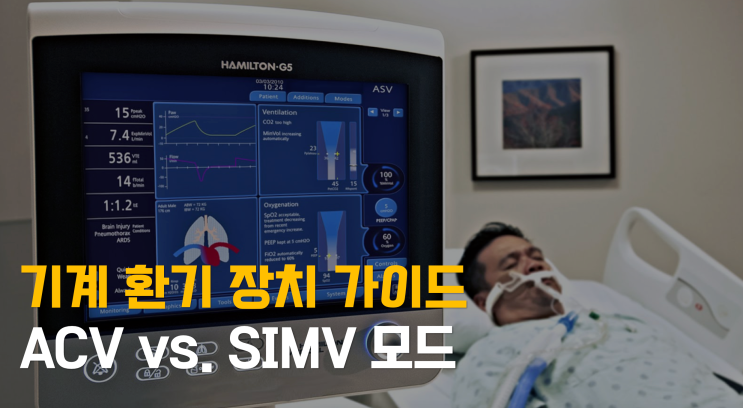 초심자를 위한 기계환기 장치 가이드 (1): ACV vs. SIMV : 네이버 블로그