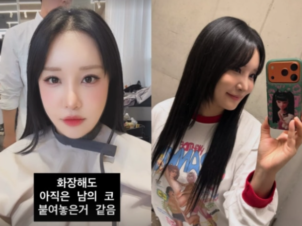 랄랄 성형 수술 후 "안색도 밝아졌다"…달라진 근황 공개