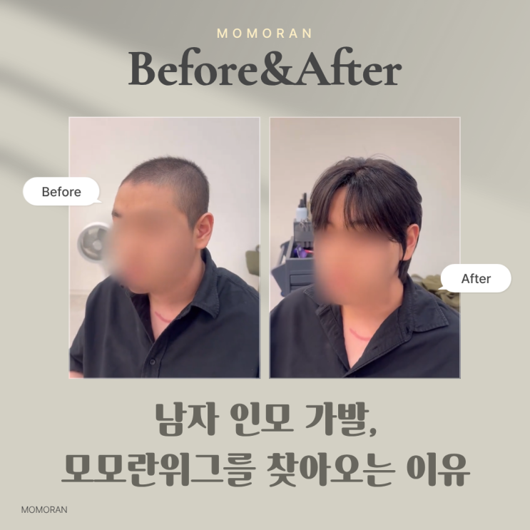 남자 인모 가발, 모모란위그를 찾아오는 이유 : 네이버 블로그