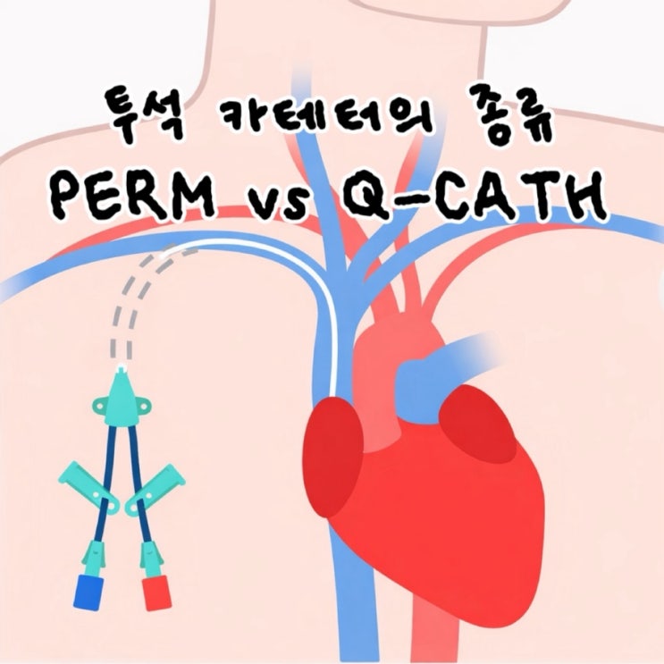 투석 카테터 종류, Q cath(Quinton catheter)와 PERM cath(Permenant catheter) 의 ...