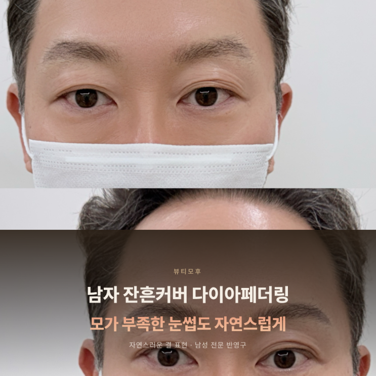 세종시 눈썹 | 남자 잔흔커버 다이아페더링, 모가 부족한 눈썹도 자연스럽게