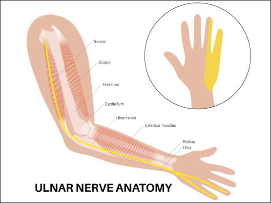 척골신경포착증후군(Ulnar Nerve Entrapment Syndrome) -1. Arcade of Struthers ...