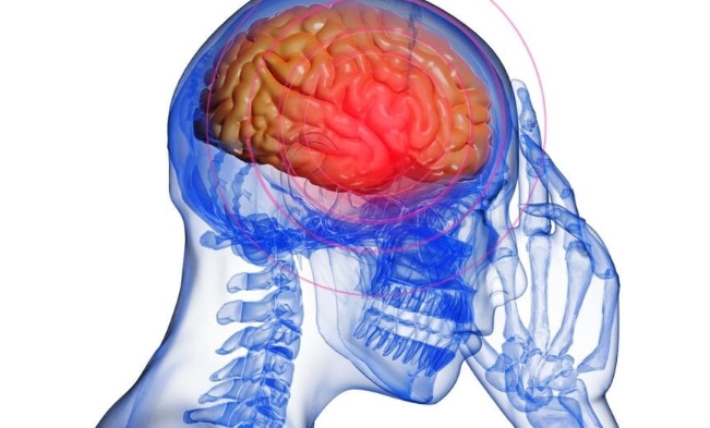 갑자기 한쪽 팔이 저린다면? 뇌경색 전조증상 7가지, 지금 당장 확인하세요 : 네이버 블로그
