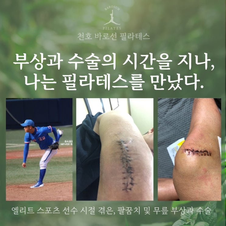 야구 선수 시절의 부상, 그리고 필라테스를 통한 회복까지 : 네이버 블로그