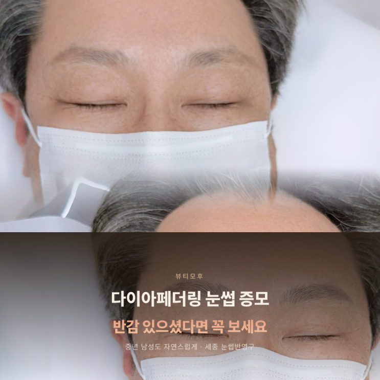 중년 남자 눈썹문신 반감 있으셨다면? 다이아페더링으로 자연스러운 눈썹 증모 효과 경험하세요