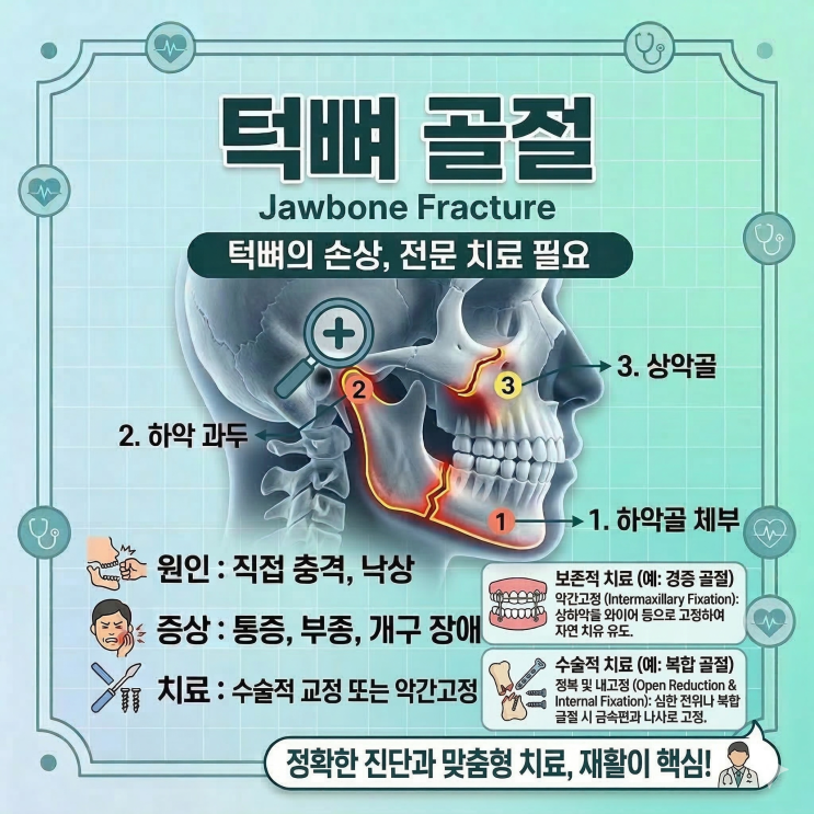 턱뼈 골절 회복했던 후기 : 네이버 블로그