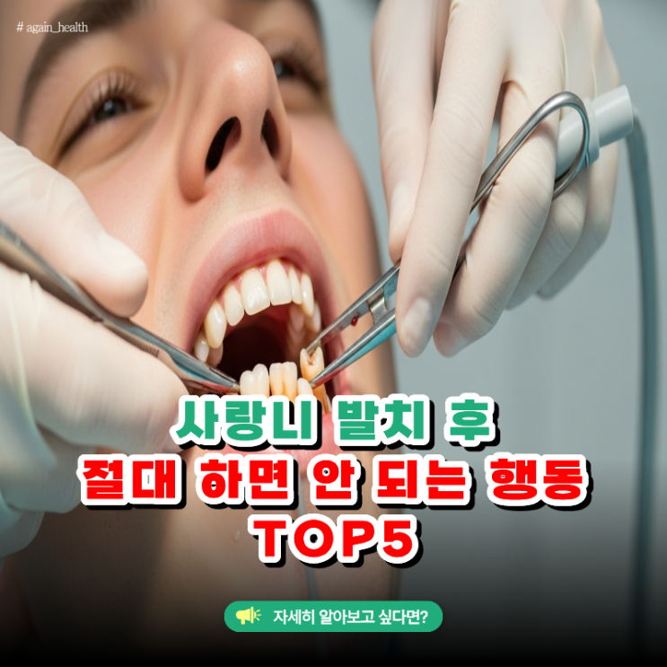 사랑니 발치 후 절대 하면 안 되는 행동 TOP5 : 네이버 블로그