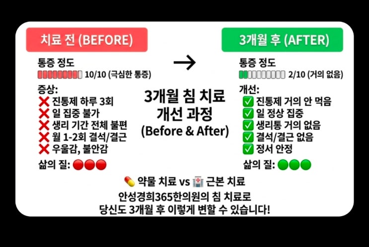 생리통, 침으로 진통제보다 빠르게 푸는 법 안성경희365한의원에서