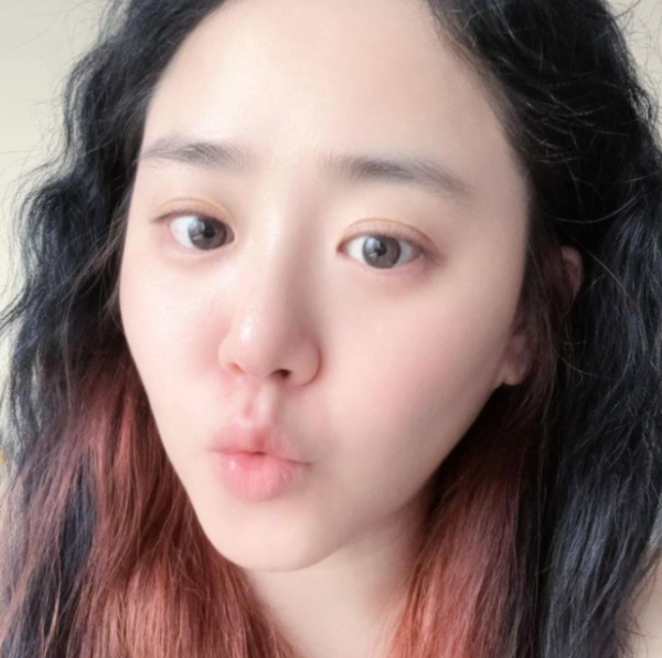 문근영, 희귀병 극복 후 9년 만의 연극 복귀 "아주아주 건강해요"