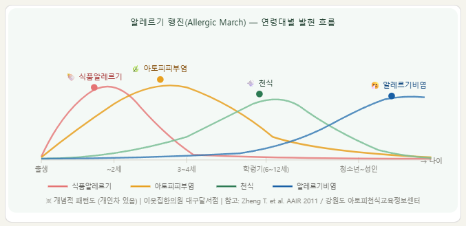 아토피·천식·비염 — 알레르기 행진이란 무엇인가? 알레르기 행진(Allergic March) 개념, 연령대별 발현 패턴 ...